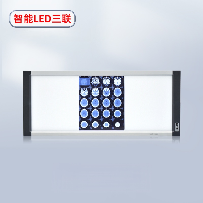 LED Induction X -ray Film Viewer